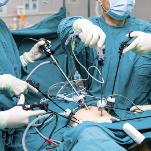 laparoscopy